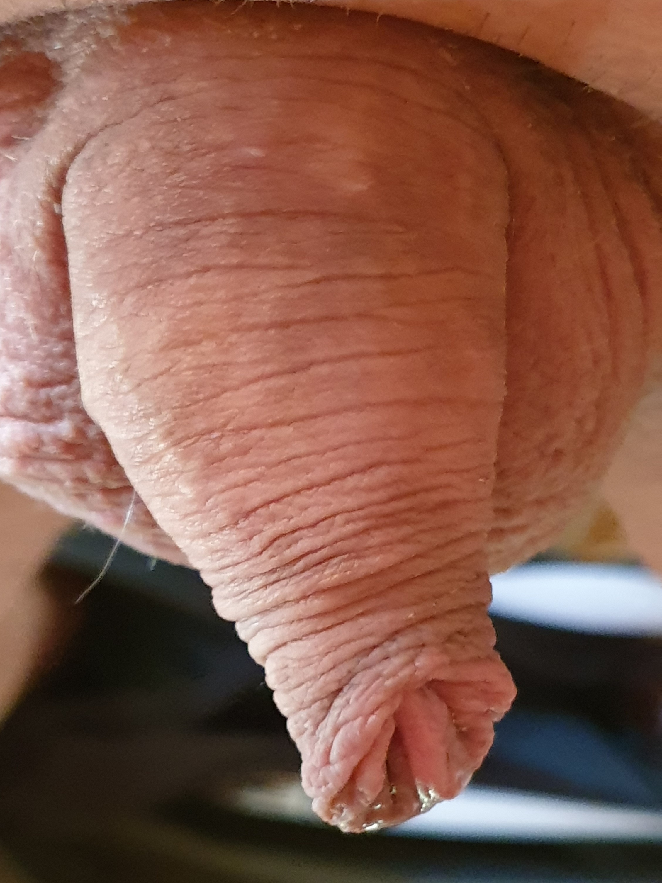 My small uncut cock — 15