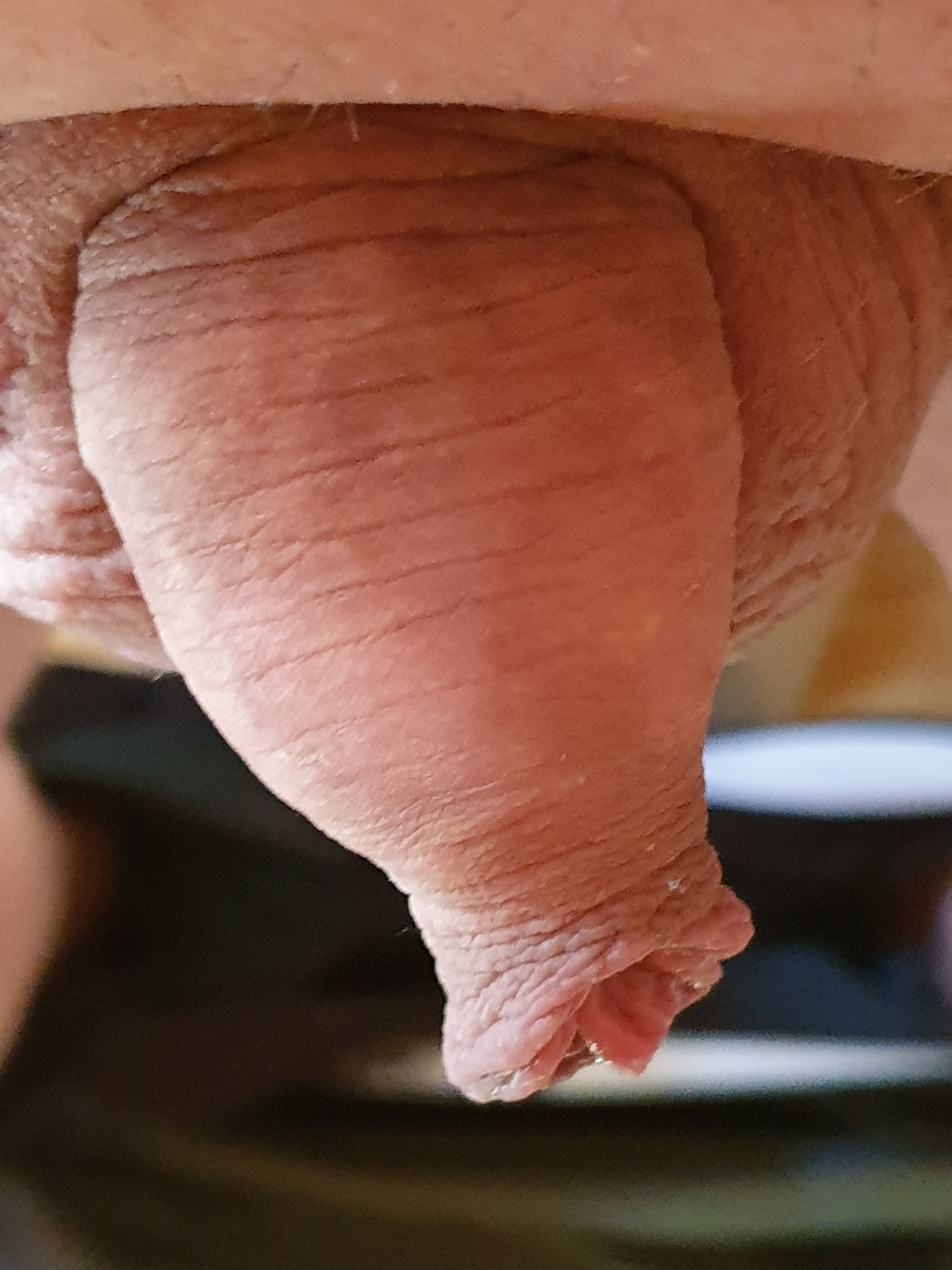 My small uncut cock — 7