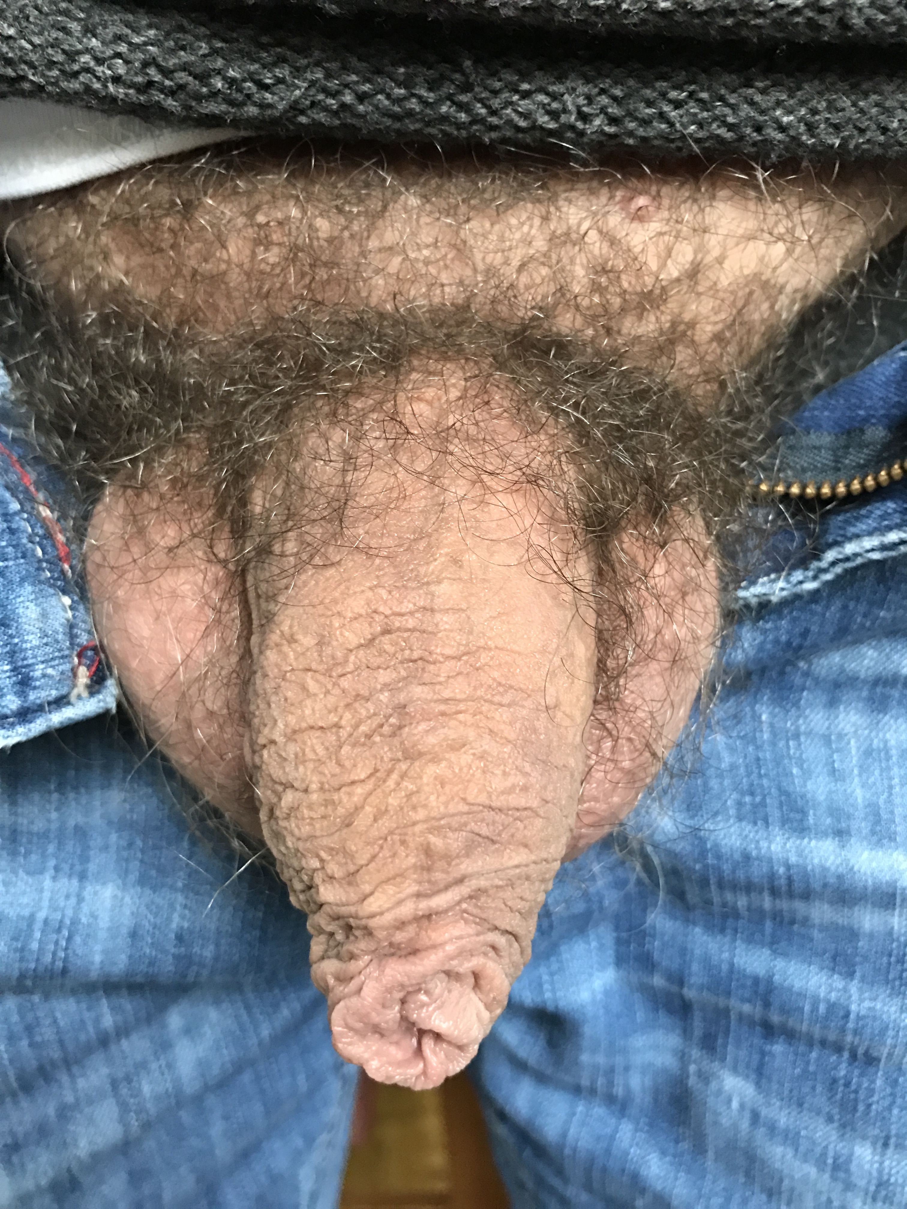 playing with my foreskin — 34